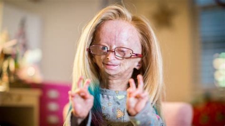 Adalia Rose Adalia Rose