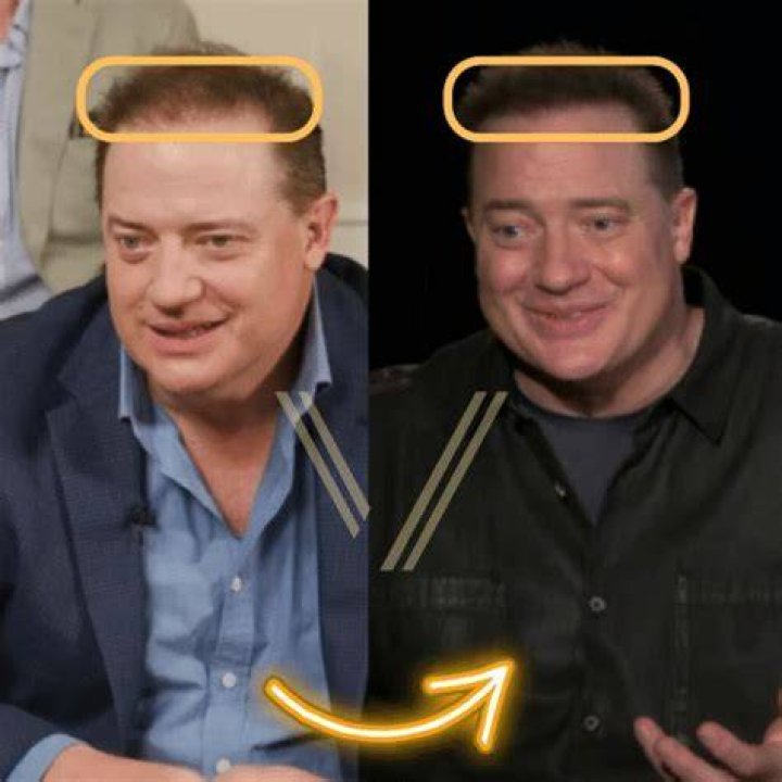 Brendan Fraser Weight Loss