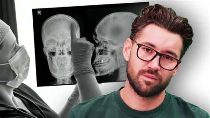 Jeff Wittek Mugshot: Before And After Accident And Eye Video Jeff Wittek Eye Video