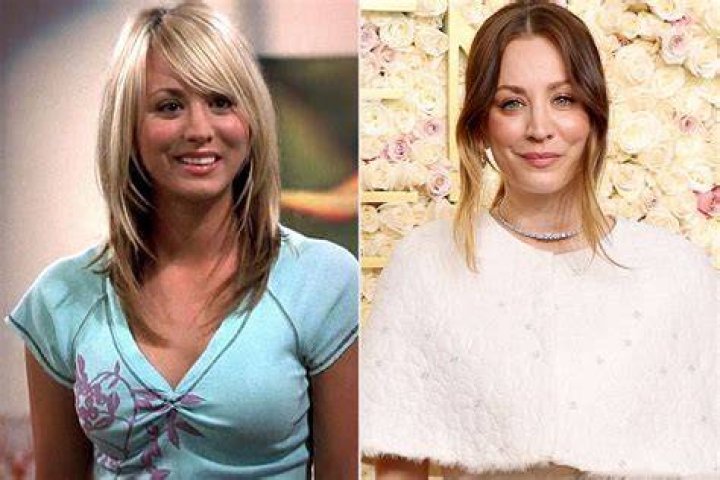 Kaley Cuoco Botox