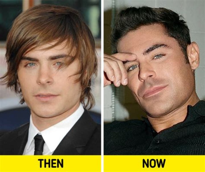 Plastic Surgery Rumors