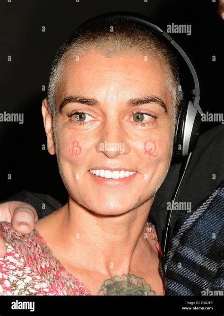 Sinead OConnor teeth